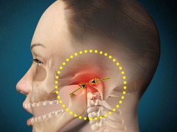 Почему болит челюсть