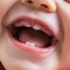 Прорезывание зубов: как облегчить состояние малыша
