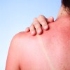 Как избавиться от аллергии на солнце?