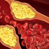 Что такое холестерин в крови