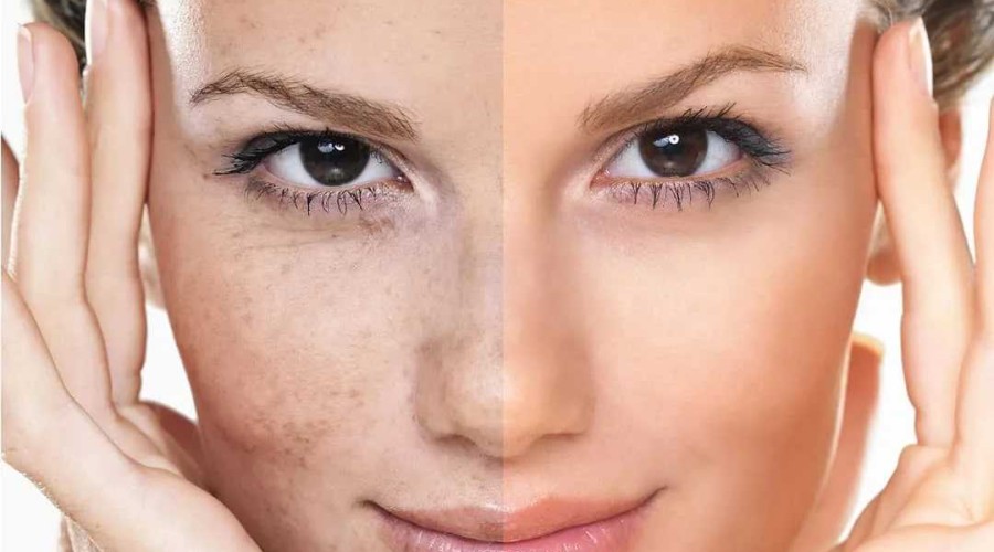 Как сделать кожу лица гладкой