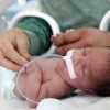 Что такое перинатальная энцефалопатия у новорожденных, лечение