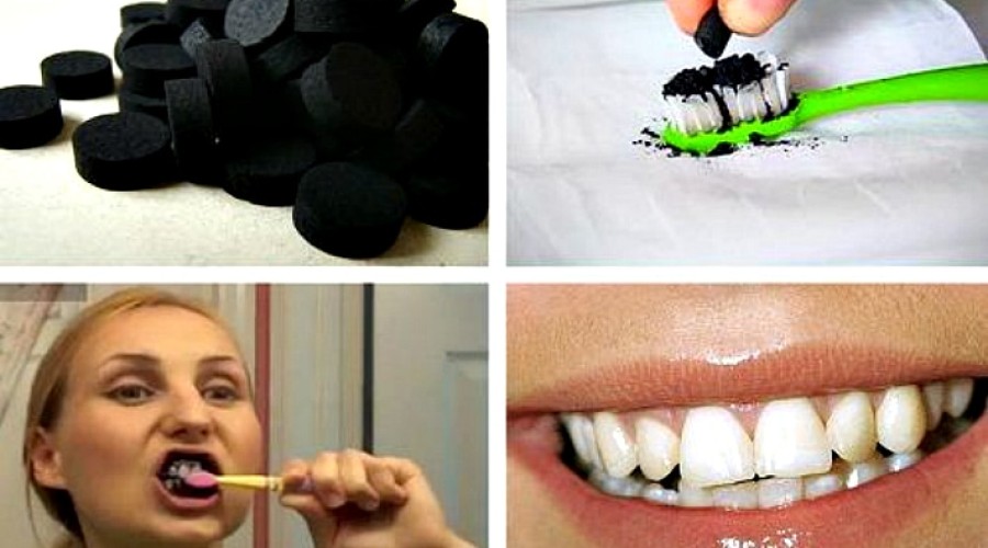 Как часто можно чистить зубы активированным углем
