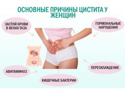 Как вылечить цистит и как его предотвратить?