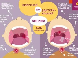 Как сбить температуру при ангине