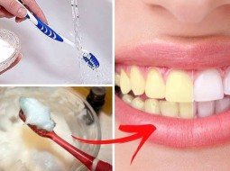 Можно ли содой отбелить зубы?