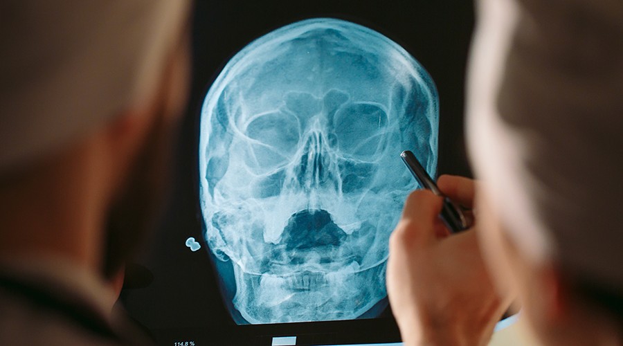  Зачем нужен рентген черепа? 