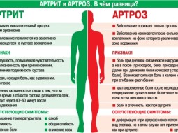 Чем ревматический артрит отличается от остеоартрита