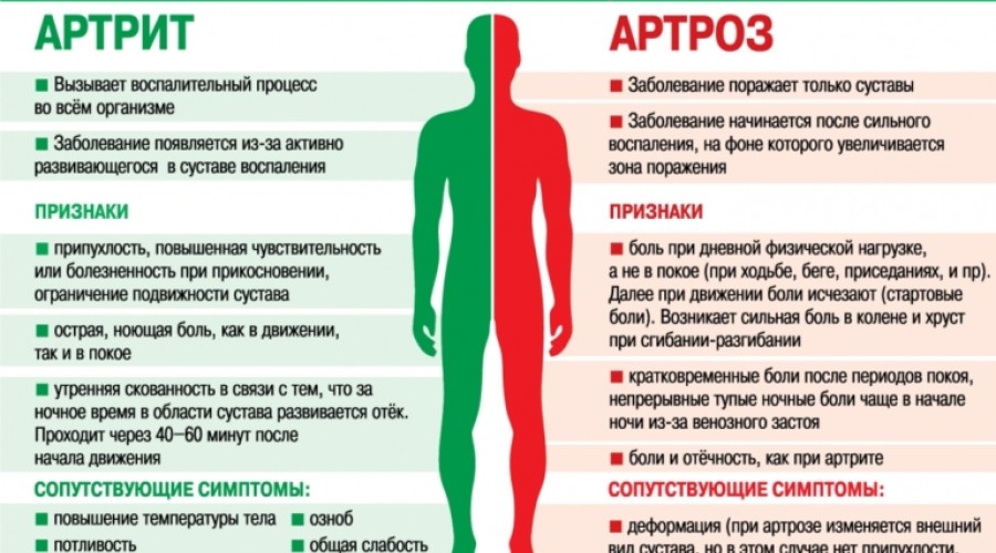 Чем ревматический артрит отличается от остеоартрита