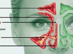 Чем опасно возникновение этмоидита